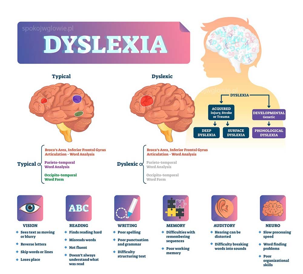 testy na dysleksję